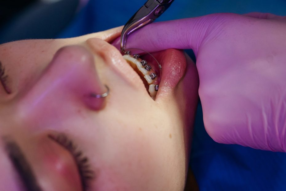 Formation en orthodontie