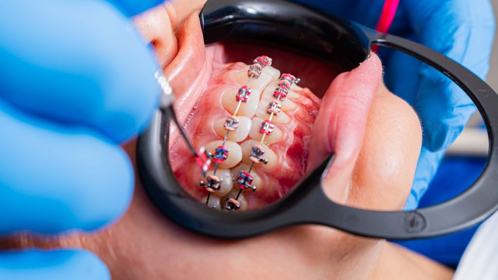 orthodontie